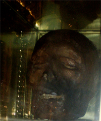 The head of Oliver Plunkett